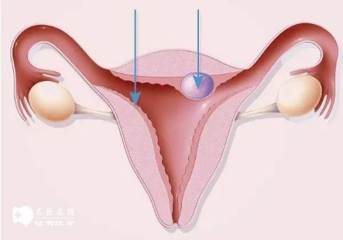 杭州试管助孕公司：不用担心人工授精的孩子，和自然受孕一样